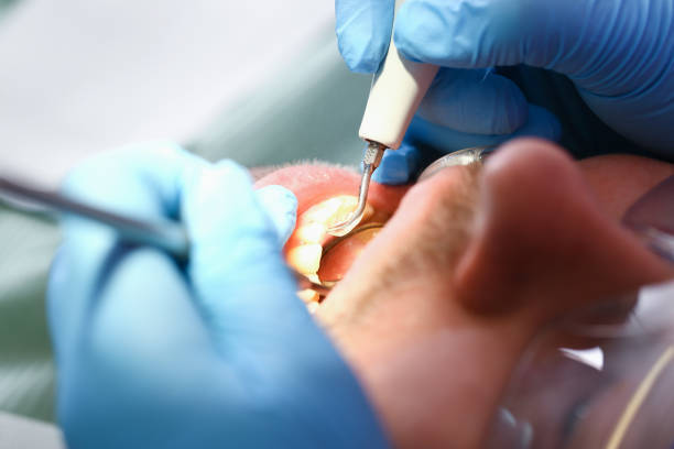 Best Pediatric Emergency Dentist in Versailles, OH