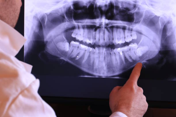 Best Urgent Care for Lost Fillings or Crowns in Versailles, OH